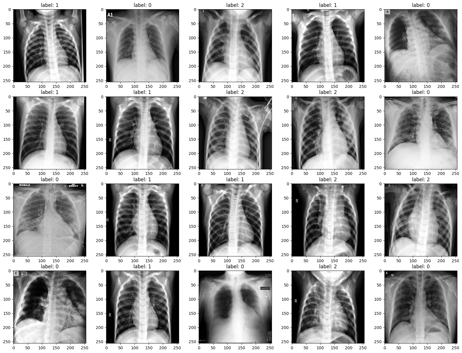 GitHub bellbpng/Covid19_image_classification_Kaggle