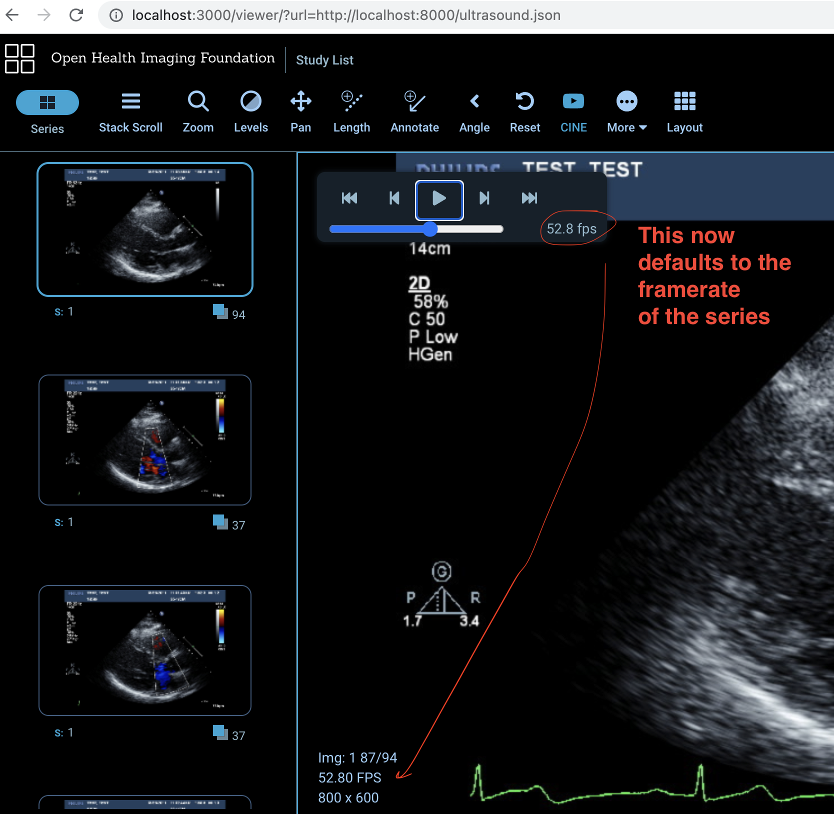 Screen Shot 2022-08-21 at 11 03 28 AM