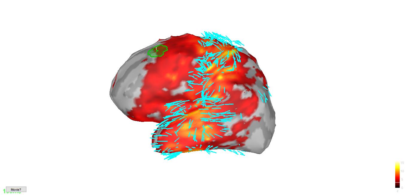 visualization of optical flow & lead field vector on cortical surfaces · Issue 277 · brainstorm