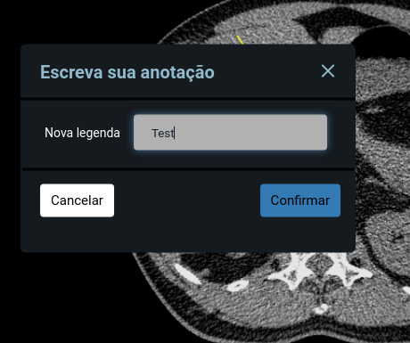 Annotation window bug · Issue #2624 · OHIF/Viewers · GitHub