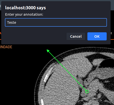 Annotation window bug · Issue #2624 · OHIF/Viewers · GitHub