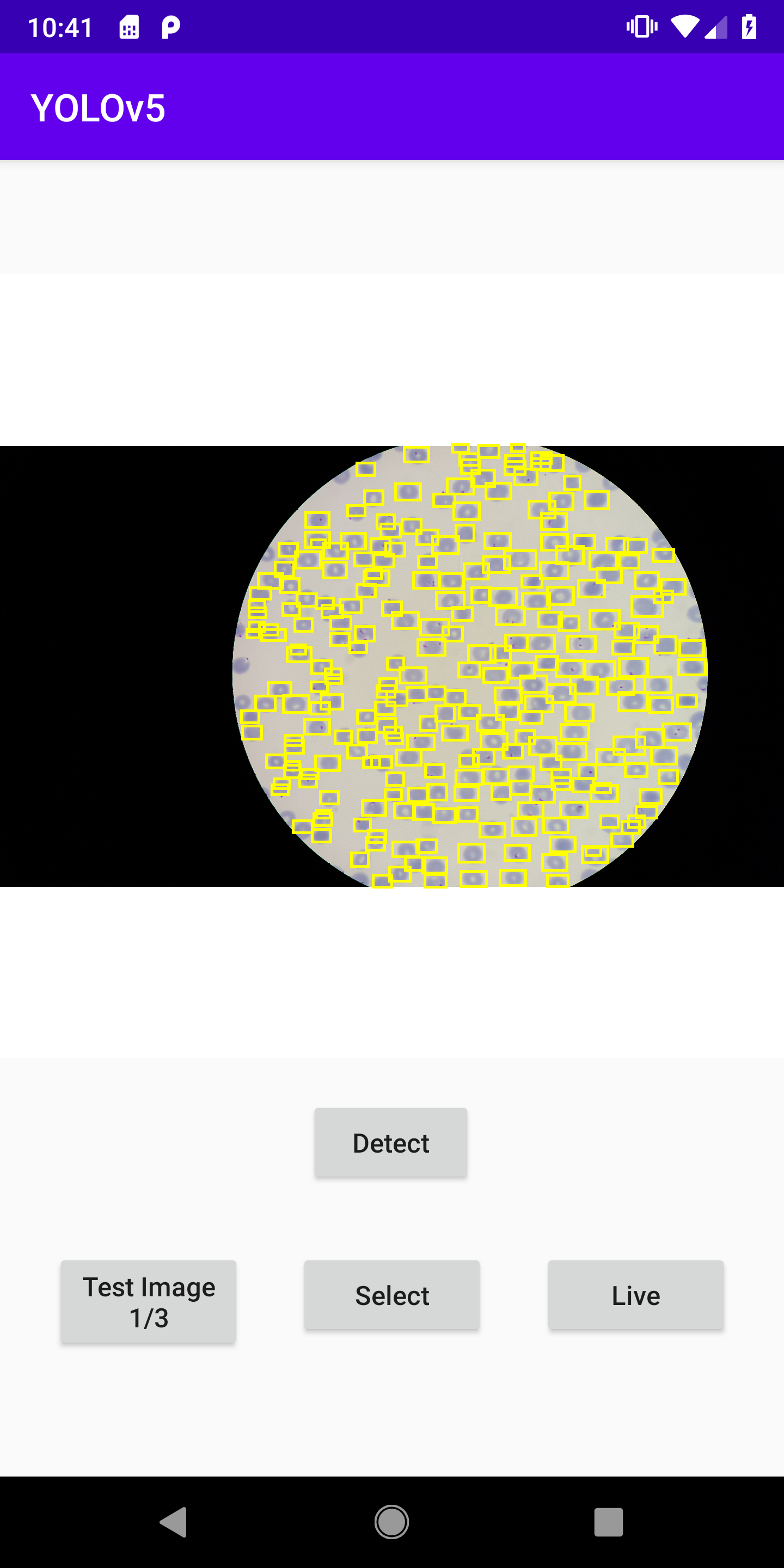 One class is not detected for custom dataset · Issue #2870 ...