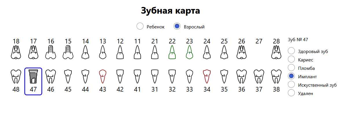 GitHub - evskorobogatij/dental_map: Прототип зубной карты