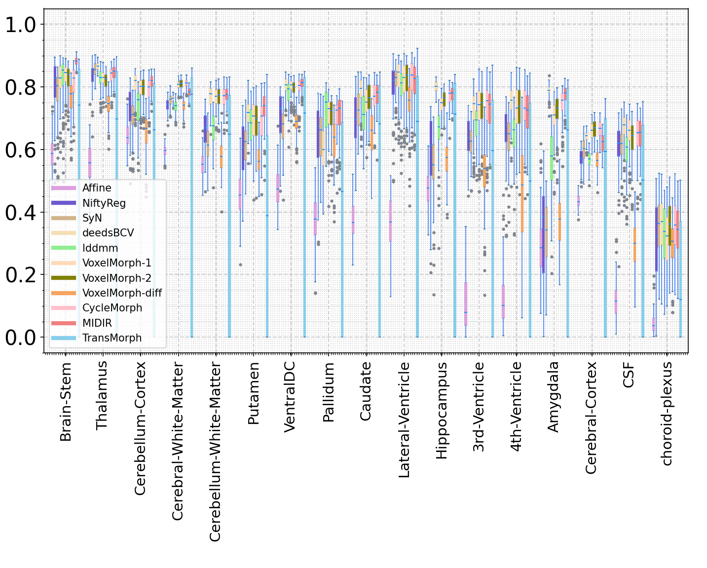 Questions about the test results of iXI dataset · Issue 11
