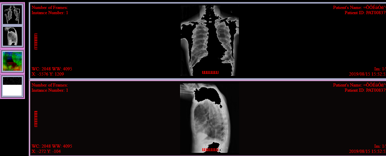 Display bug · Issue 484 · cornerstonejs/cornerstone · GitHub