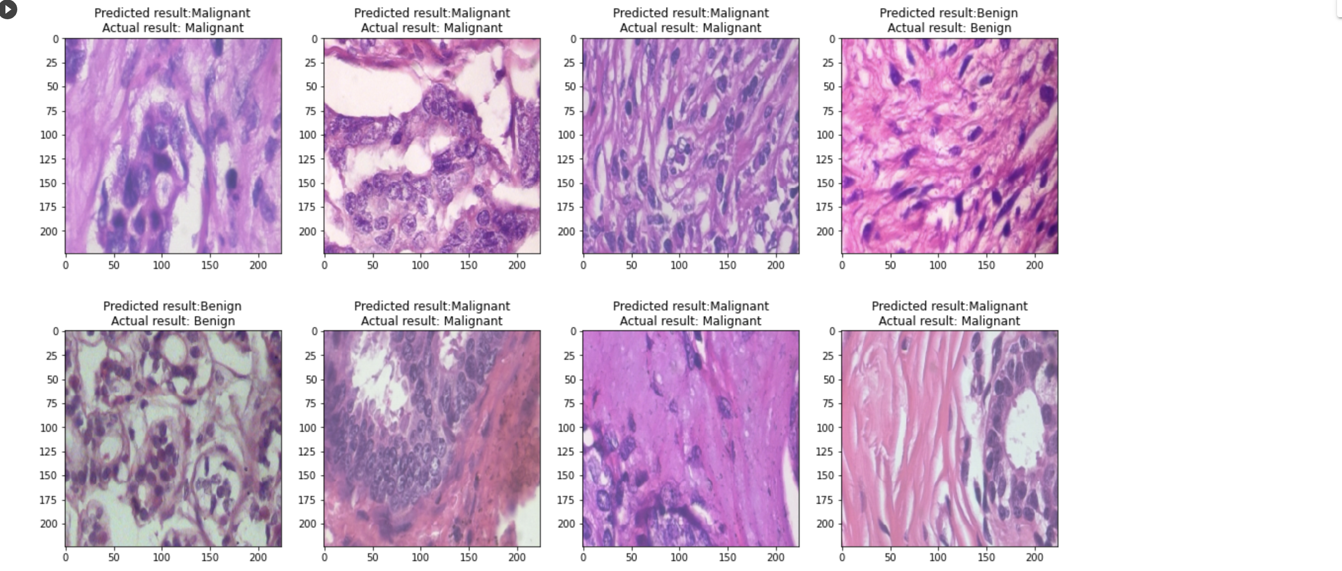 GitHub - Gitanjali1994/Histopathological_Prediction