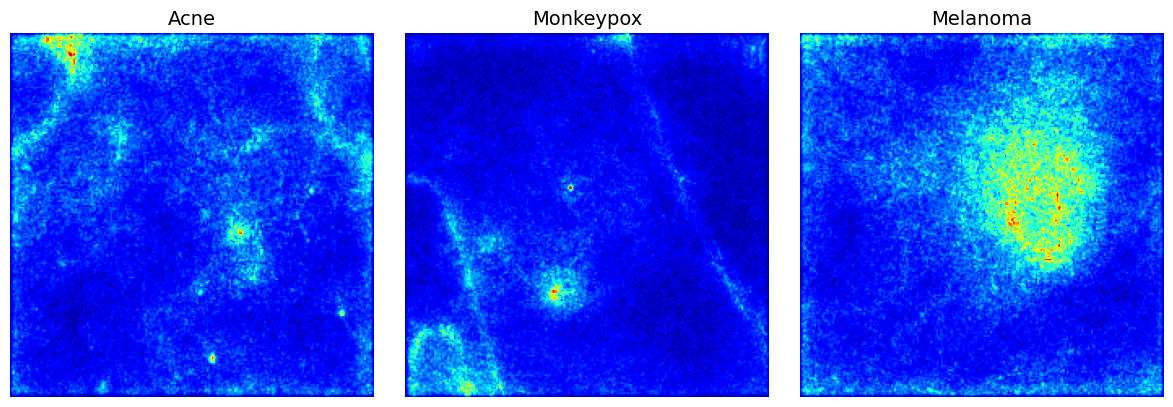 GitHub - Vithyashagar/disease_detection