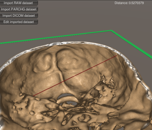 Volume raycaster · Issue #140 · mlavik1/UnityVolumeRendering · GitHub