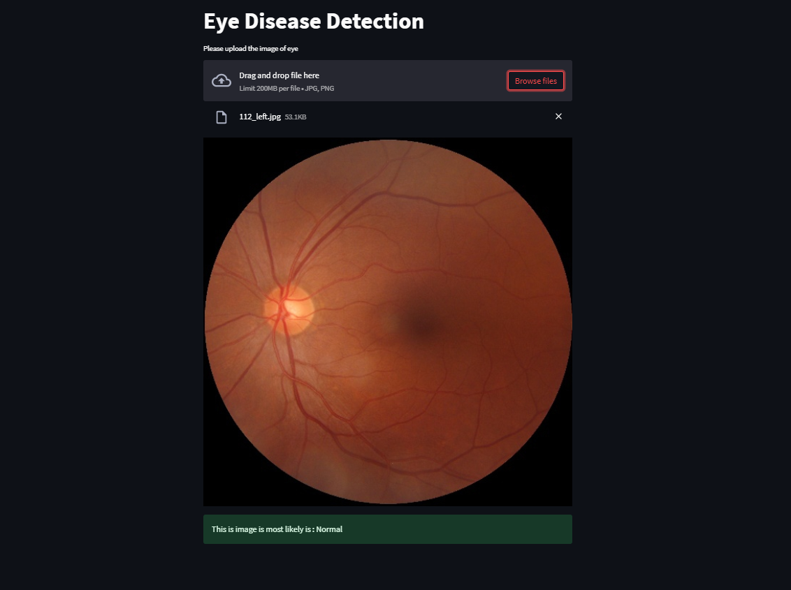 GitHub - ishivamsharma/eye_disease_detection