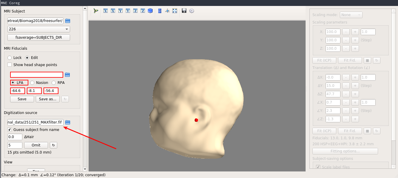 Digitalization source is not flush when changing subject in MNE Coreg ...