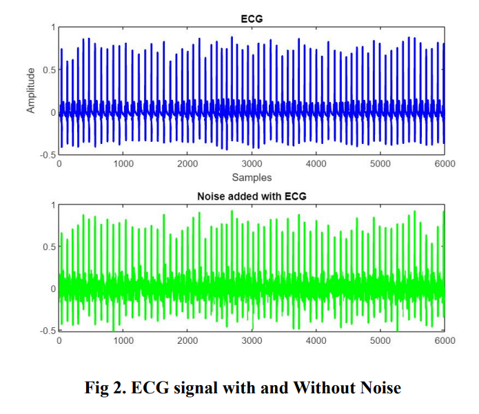 GitHub Prar2902/ECGSpO2OSADetectingObstructiveSleepApneausing