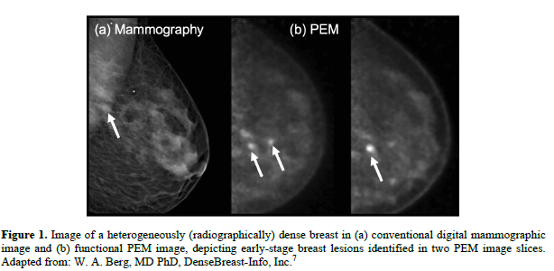 Pem Scan Assessment of system performance and phantom validation of ultrasound ...