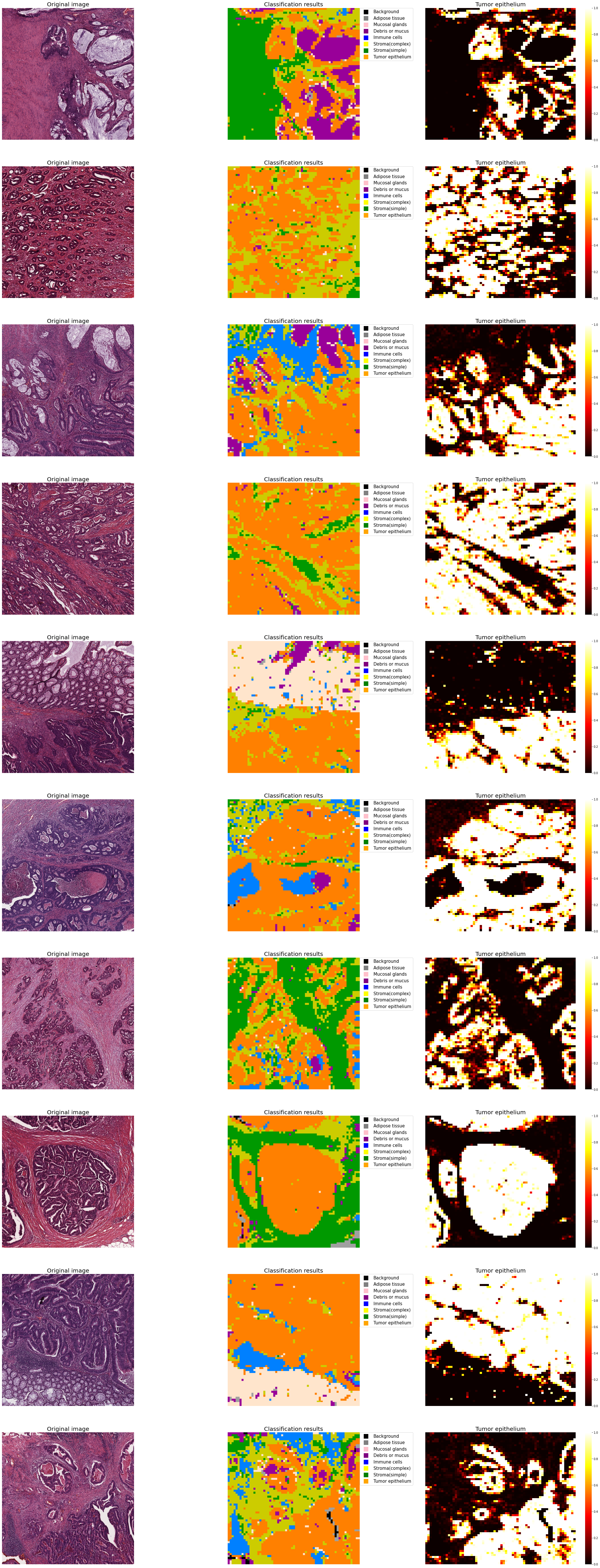 GitHub - StasVino/Histopathology-Classification