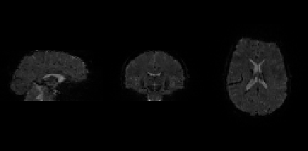 echo-03