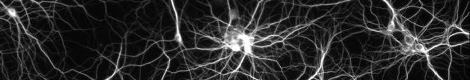 GitHub - SB-DA/Neural_Network_Charity_Analysis: Created a deep-learning ...