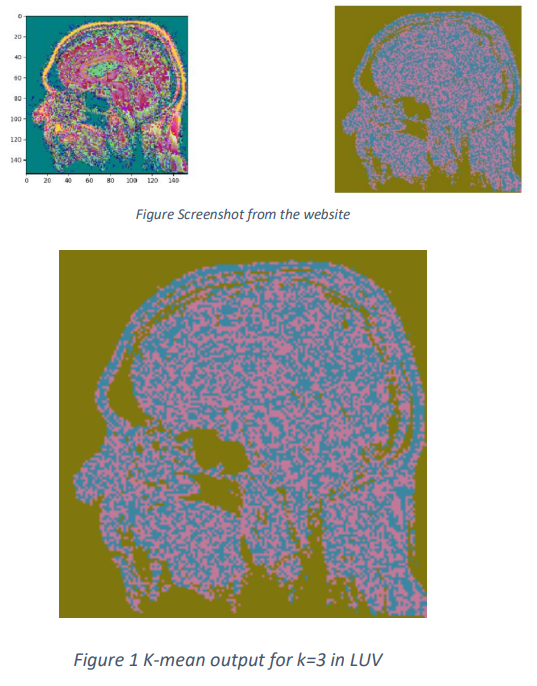 GitHub - ezzat223/Computer-Vision_Image-Segmentation-and-Thresholding ...