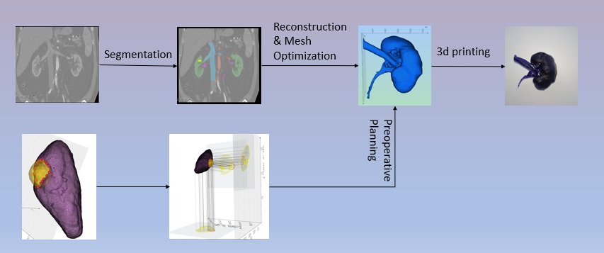 GitHub - SpyridoulaZagkou4/Thesis_Kidney_Reconstruction