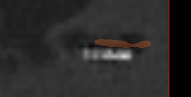bug