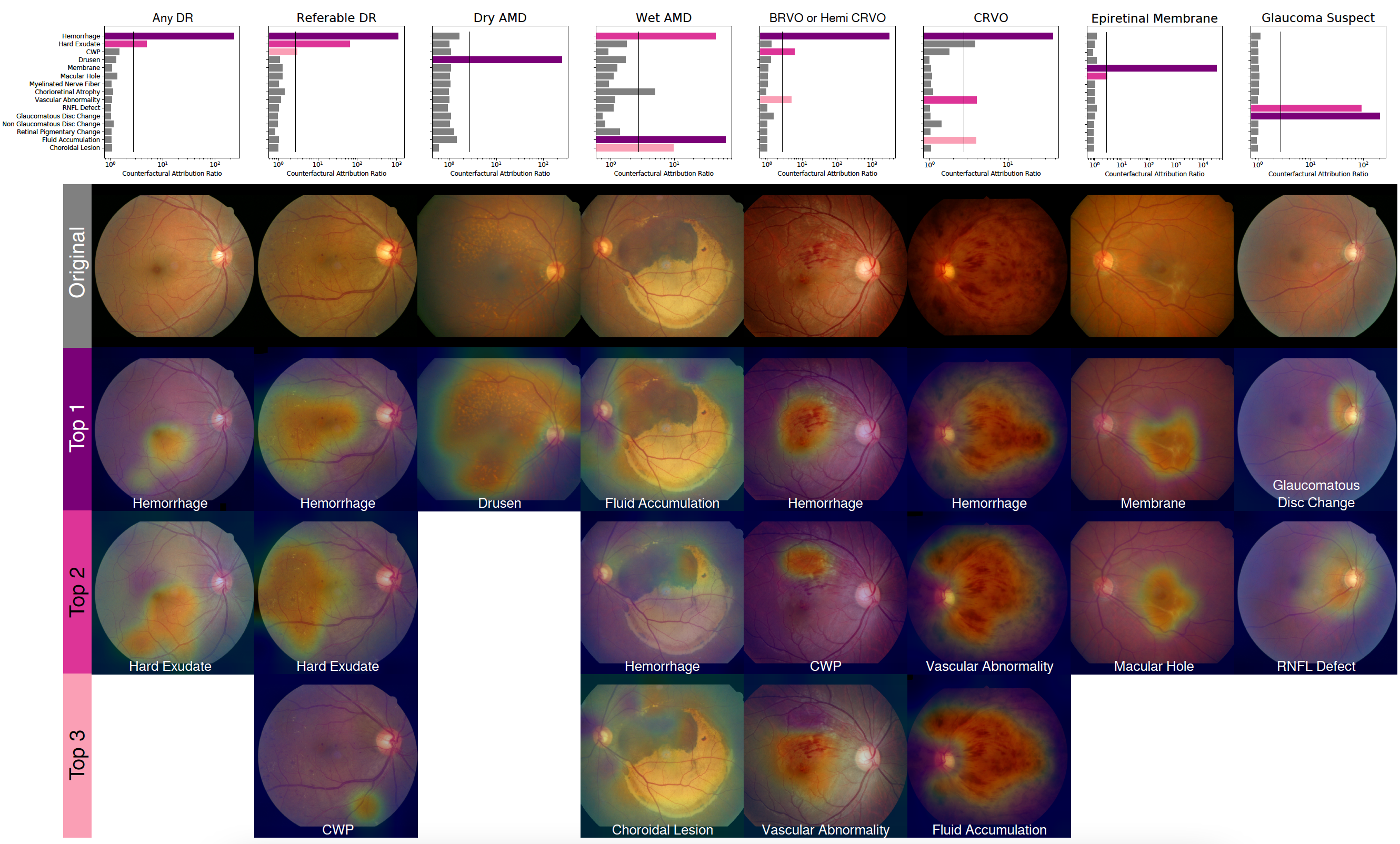 GitHub - jaeminSon/InterpretableDeepLearning: Some code snippets in the ...