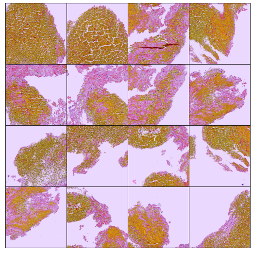 GitHub - Krisila/MAYOCLINIC_PROJECTFINAL: Code for submittal to ...
