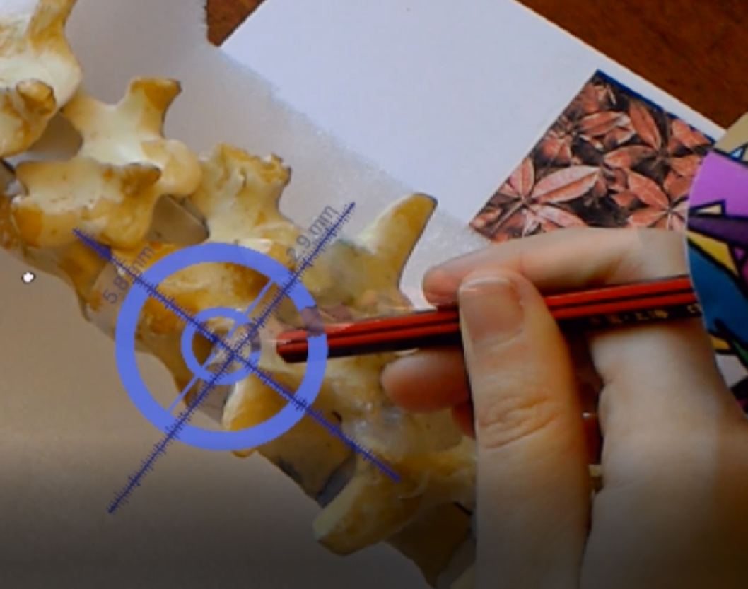 Github Ozelotl Medicalarproject Project For Medical Augmented