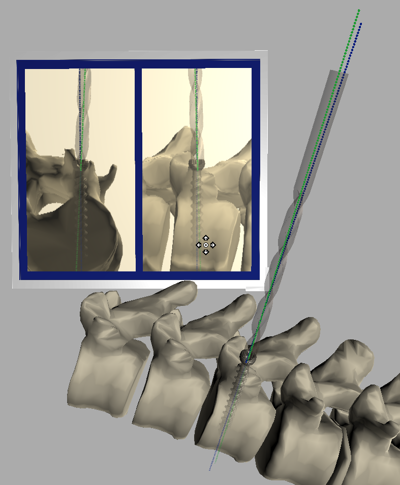 Github Ozelotl Medicalarproject Project For Medical Augmented