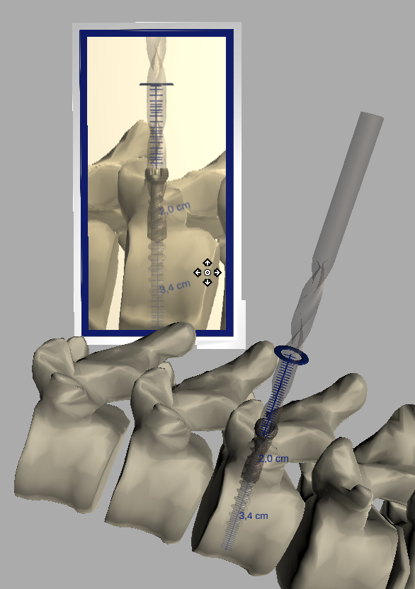 Github Ozelotl Medicalarproject Project For Medical Augmented