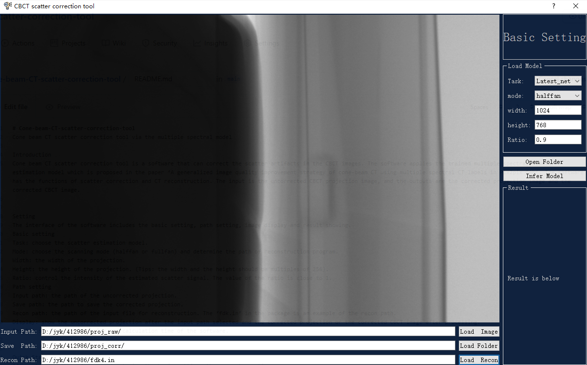 GitHub YangkangJiang/ConebeamCTscattercorrectiontool