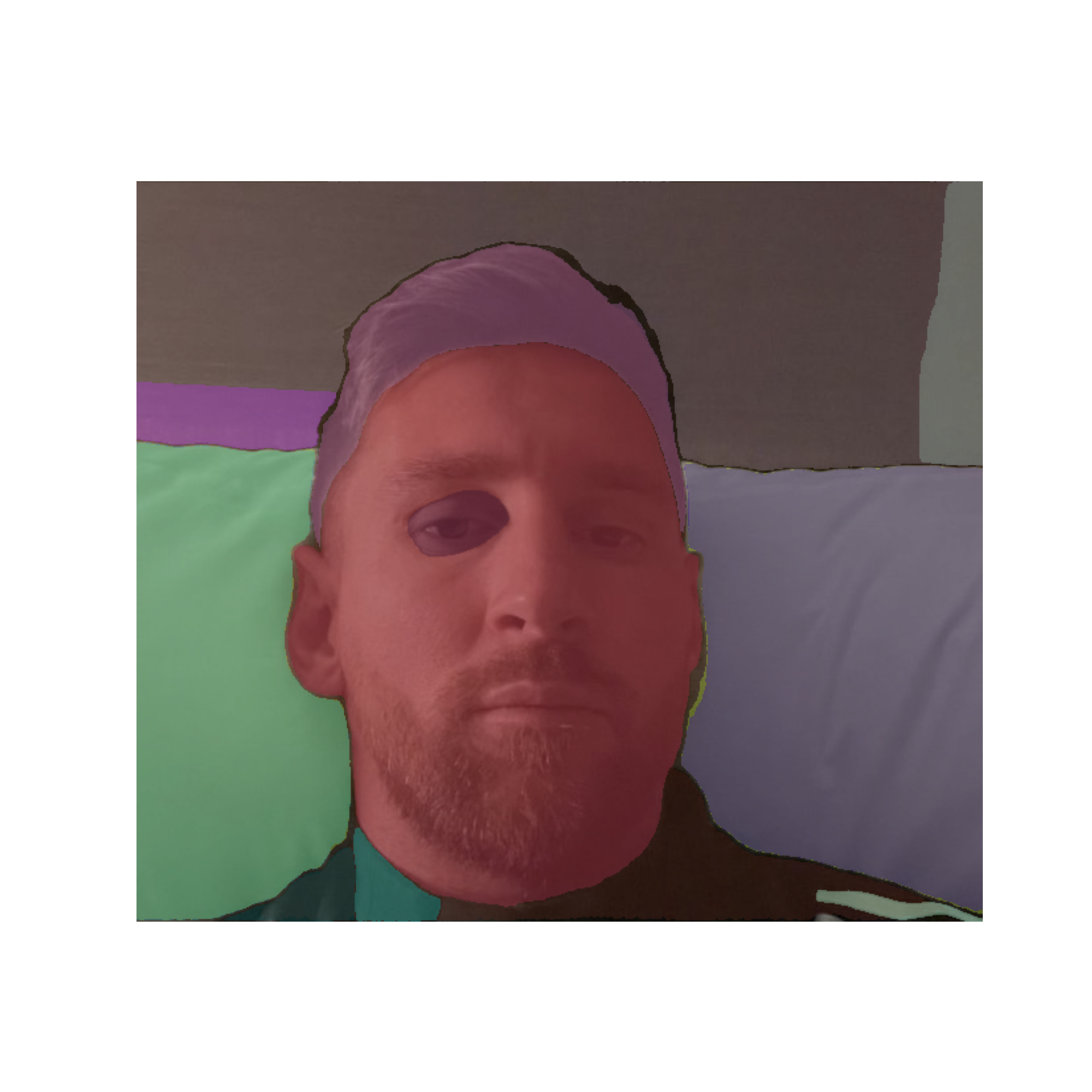 vit_h-14-52-09-3 6000053882598877-13-masks