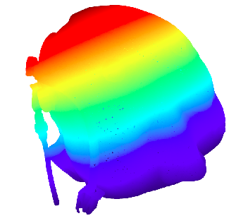 GitHub - renxingqiao/Surgical-robot: 用于脑卒中的手术机器人 · GitHub