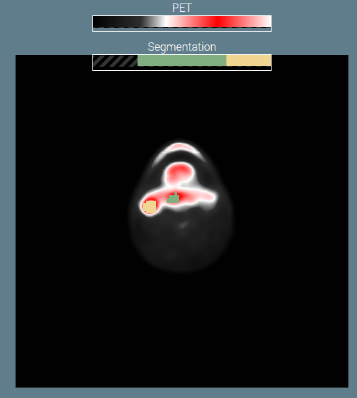 grafik