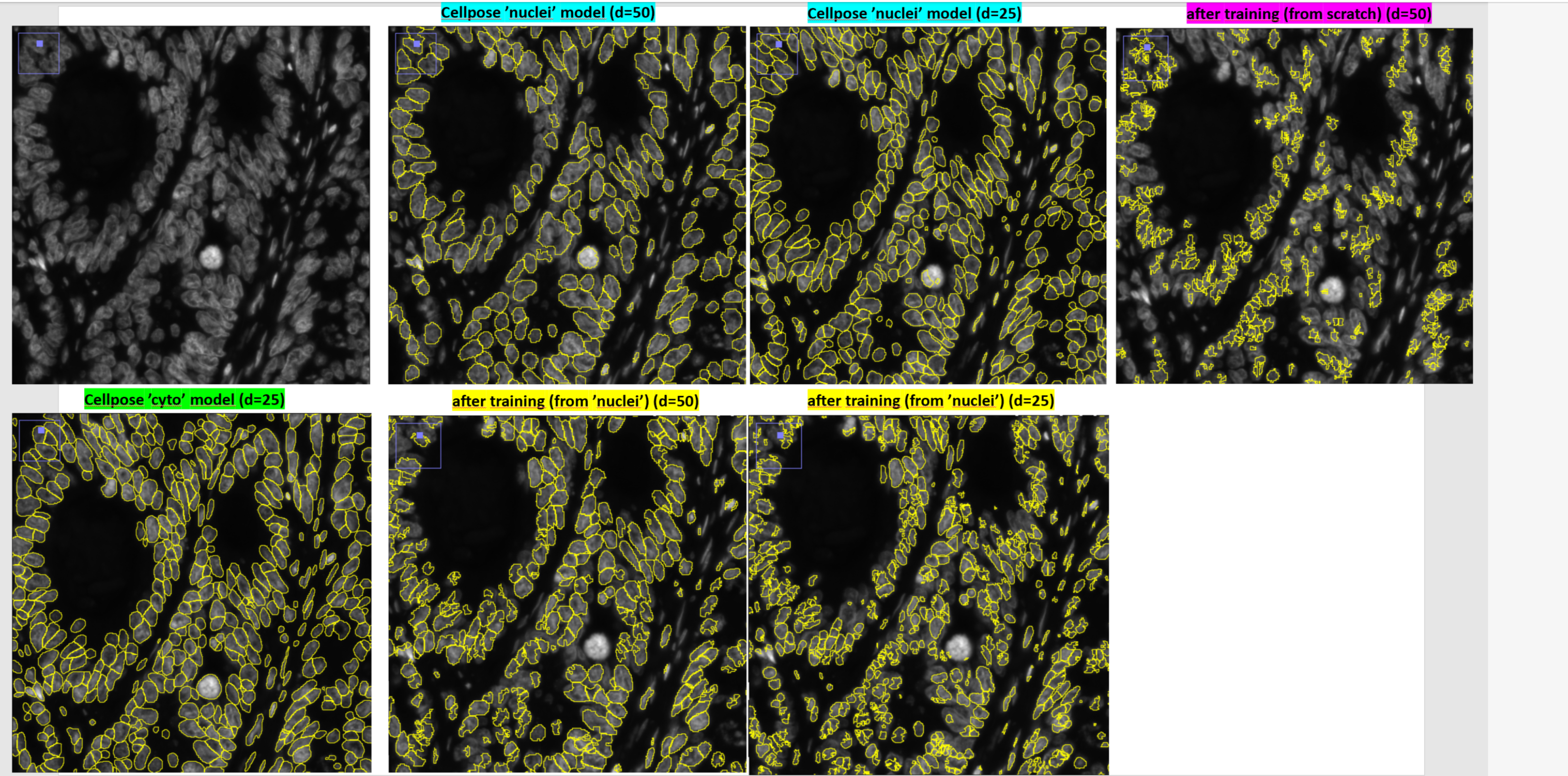 segmentation get worst after training from default cellpose model ...