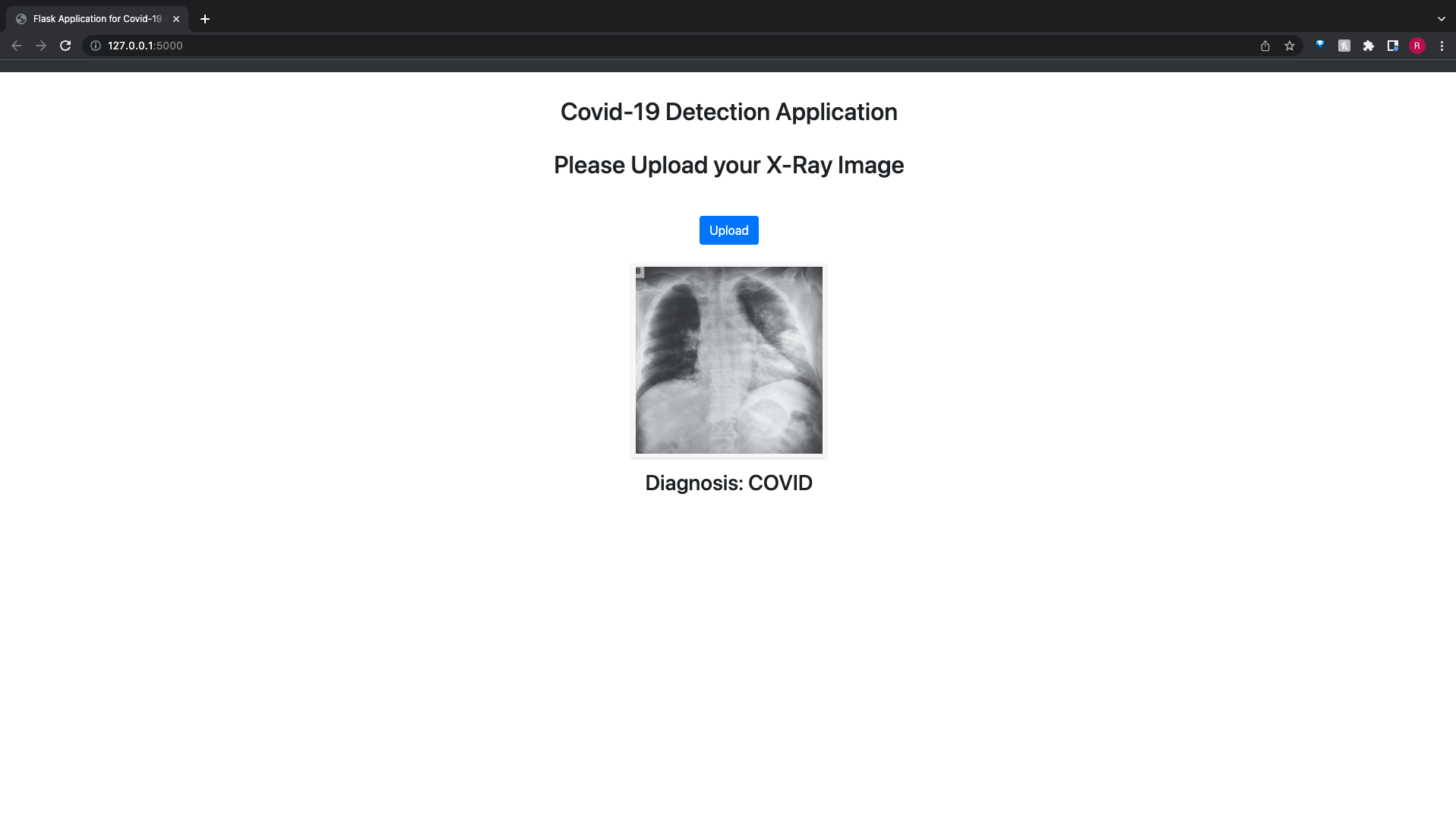 GitHub - rohitkphilip/covid19-detector-webapp