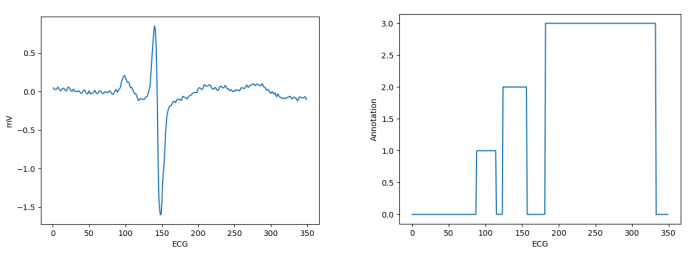 GitHub - elahesalari/Recurrent-Neural-Networks-RNN-: Detection and ...