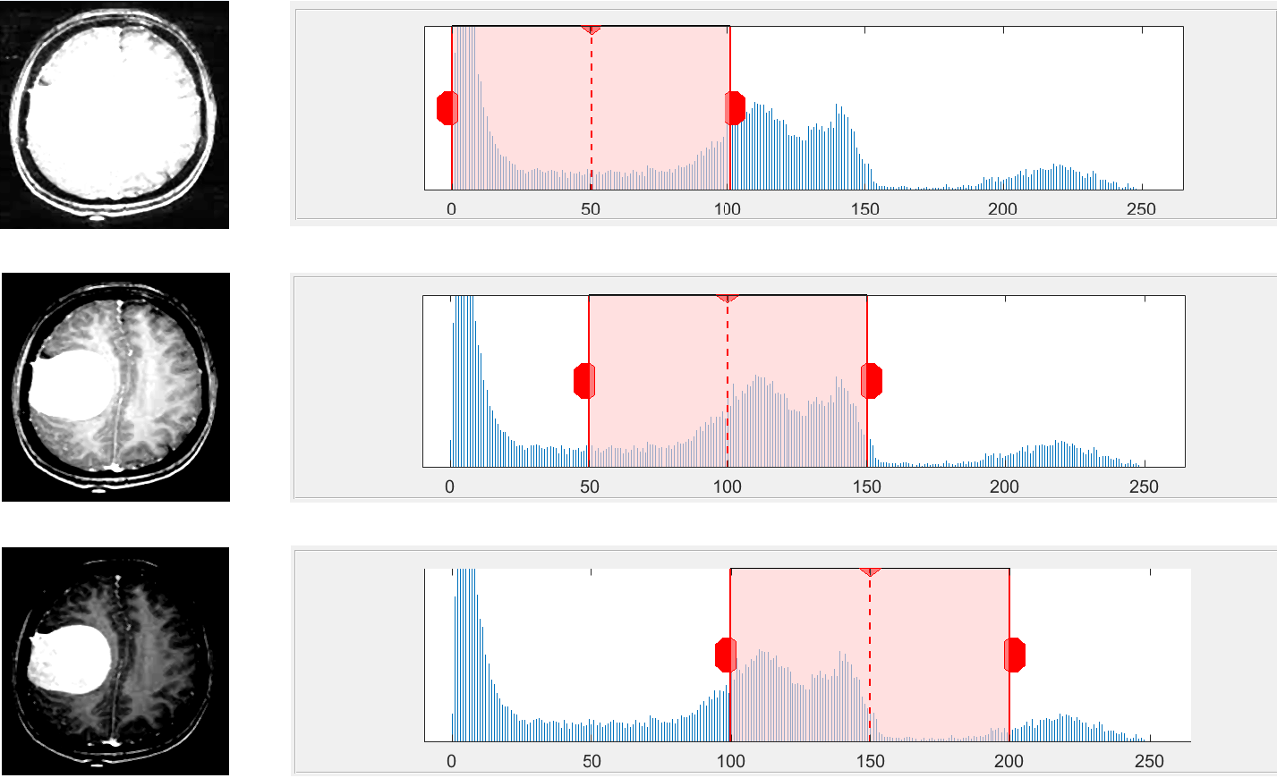GitHub - zahrakhoshdel/brain-tumour-detection-and-classification ...