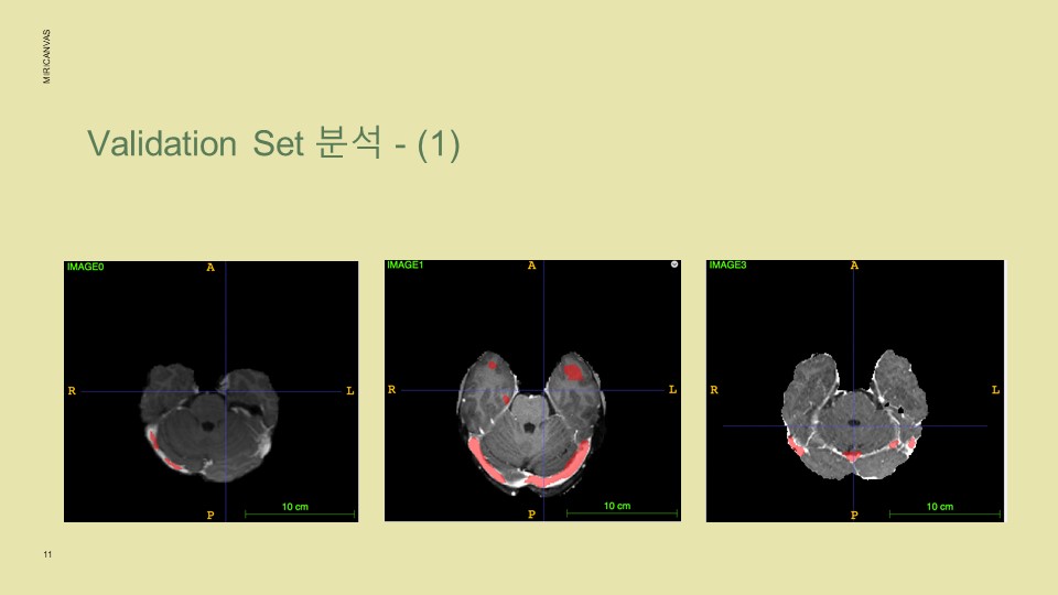 GitHub - MuHyeonSon/Medical_Image_Processing: Medical image processing ...