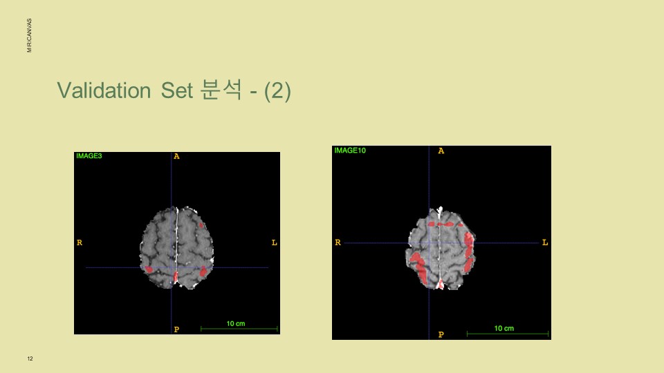 GitHub - MuHyeonSon/Medical_Image_Processing: Medical image processing ...