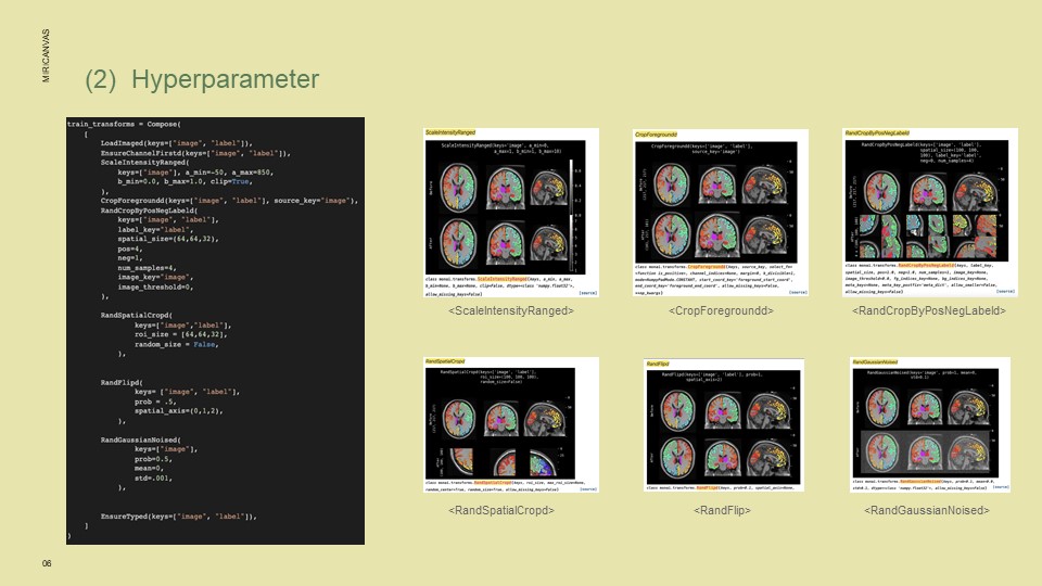 GitHub - MuHyeonSon/Medical_Image_Processing: Medical image processing ...