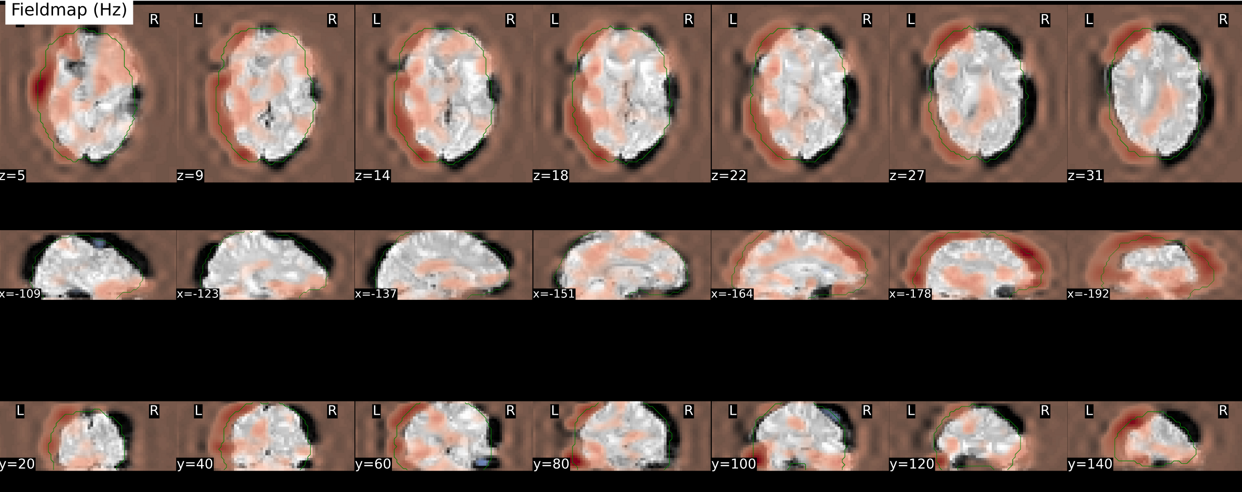 sub-01_fmapid-auto00000_desc-anat_fieldmap