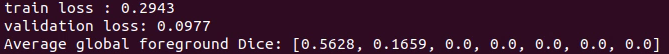 Problems with Dice while training · Issue #905 · MIC-DKFZ/nnUNet · GitHub