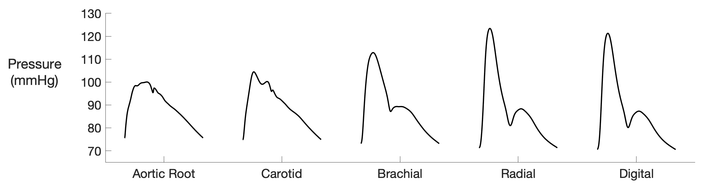 carotid pulse wave