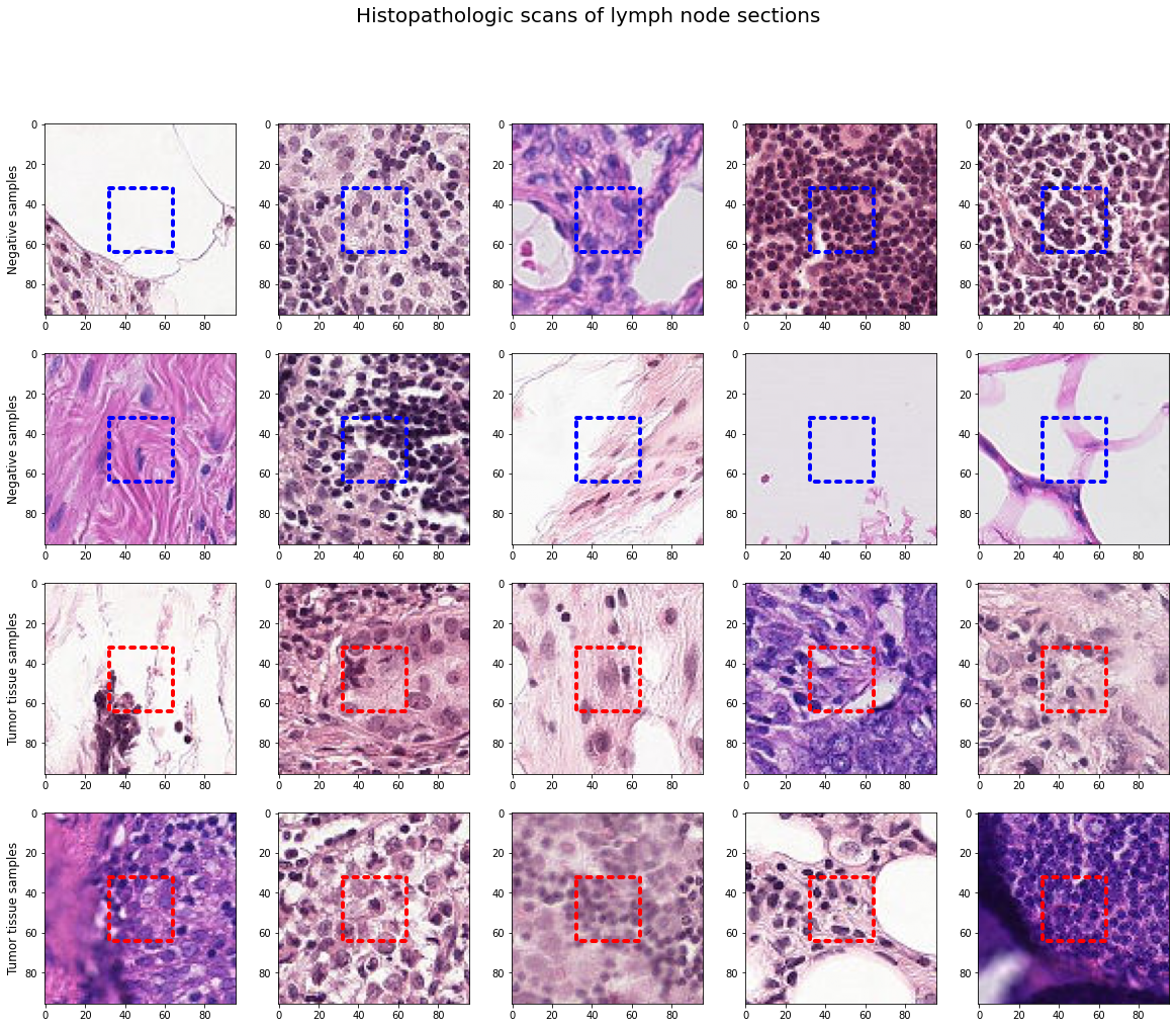 GitHub - guoguolee88/Histopathologic-Cancer_Detection